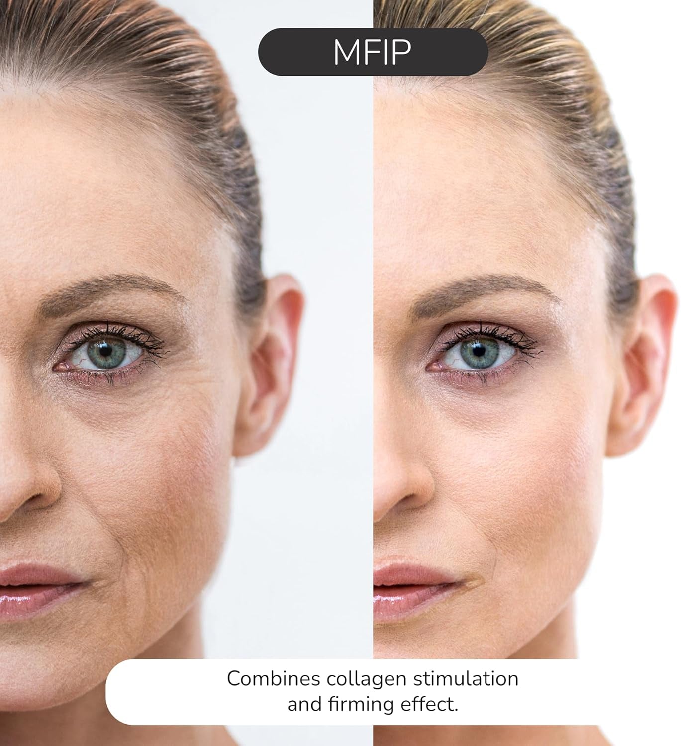 ® Face Massager with Radio Frequency Skin Tightening & EMS Red Light Therapy for Face & Neck Lift – Sculpting Device with 20 Radiofrequency Heads, Portable and Lightweight for Face Toning