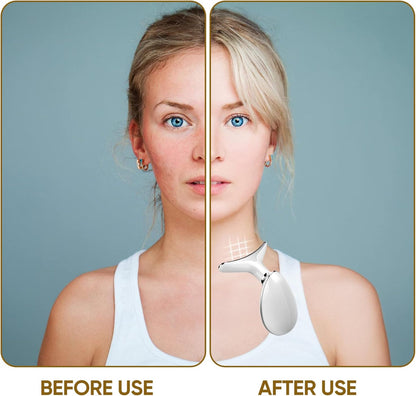 Electric Face Massager,Beauty Device for Face and Neck,High Frequency Vibration Firming Wrinkle Removal Device,Ems Care Massage Heating Equipmen. (3 Light Modes-White)