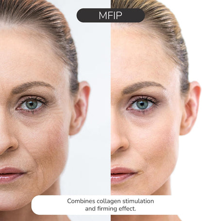 ® Face Massager with Radio Frequency Skin Tightening & EMS Red Light Therapy for Face & Neck Lift – Sculpting Device with 20 Radiofrequency Heads, Portable and Lightweight for Face Toning