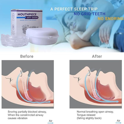 Dream Hero Mouth Guard Snoring Mouth Guard anti Snoring Mouthpiece, Mouth Guard for Teeth Grinding Sleep Anti-Molar Reusable Mouth Guard Gift for Man Women Better Sleep (White)